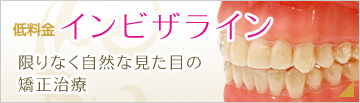 インビザライン
