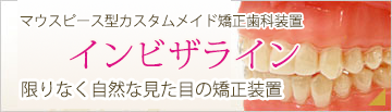 インビザライン