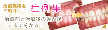 治療実績を紹介・症例集