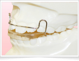 リテーナー(保定装置)