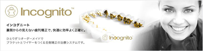 インコグニート