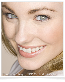 インビュー(InVu)