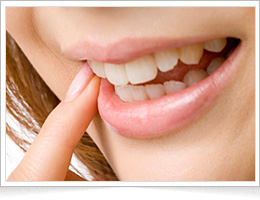 治療後のホワイトニング