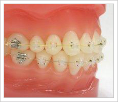 装置を装着した外観