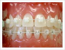 装置を装着した外観(正面)